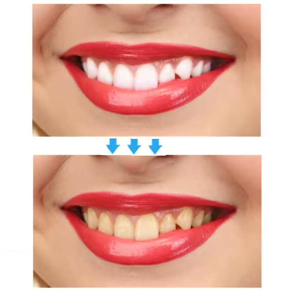 Bandes de Blanchiment Dentaire Lumineux - 7 Traitements pour un Sourire Éclatant