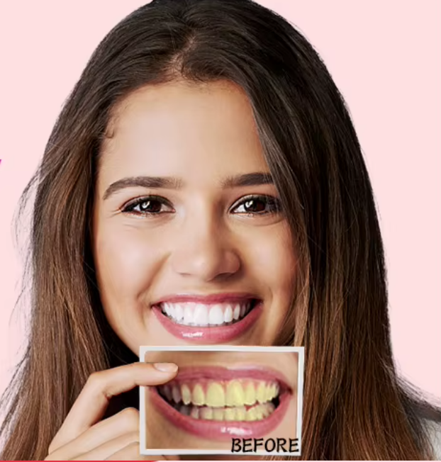 Bandes de Blanchiment Dentaire Lumineux - 7 Traitements pour un Sourire Éclatant