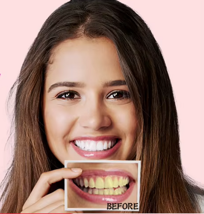 Bandes de Blanchiment Dentaire Lumineux - 7 Traitements pour un Sourire Éclatant