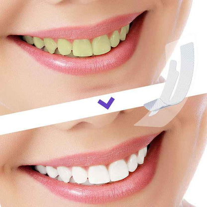 Bandes de Blanchiment Dentaire Lumineux - 7 Traitements pour un Sourire Éclatant