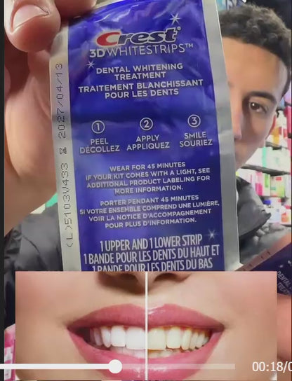 Teeth Whitening Strips (box1)